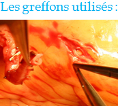 Greffons utilisés